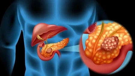 Uzmanı pankreas kanserine karşı uyardı: ‘Artan sigara kullanımı riski yükseltiyor’